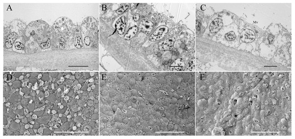 Transmission and scanning electron micrographs of Bathymodiolus platifrons gill filaments dissected freshly upon collection (A, D) and after 34 days long-term maintenance under a methane-supplied environment (B, E) or methane-absent environment (C, F).