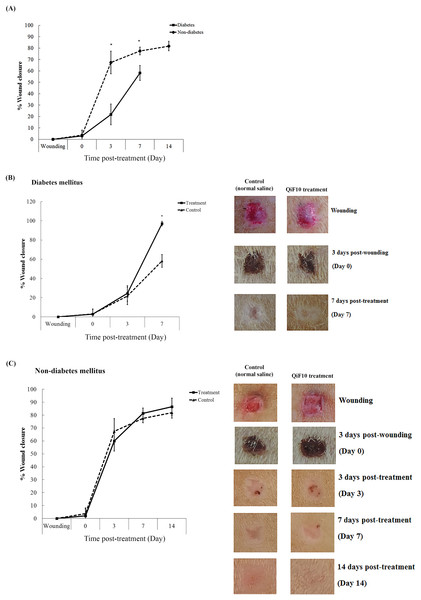 Wound healing response in diabetic and non-diabetic groups.