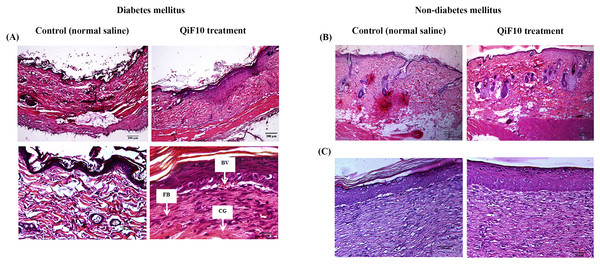 Histological images of diabetic (A) and non-diabetic wounds (B–C).