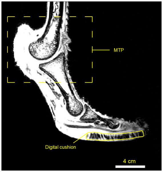 MRI image of the ostrich foot with the MTP and digit cushion.