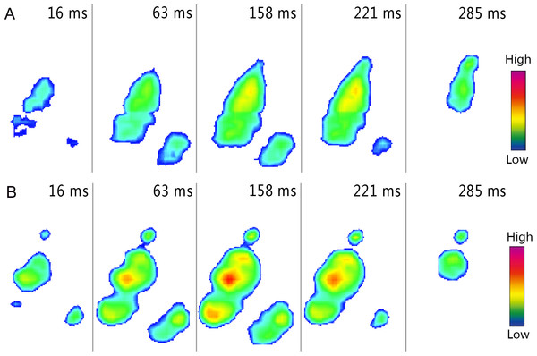 Roll-off patterns of the right toe during loose sand (A) and solid ground (B) running trials.