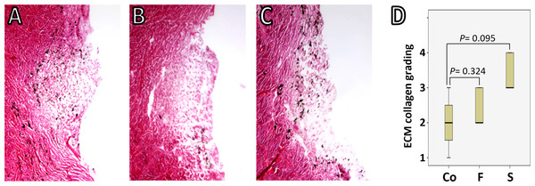 TM-ECM assessment by collagen staining.