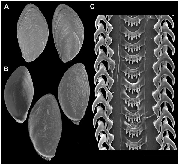 Operculum and radula morphology of Anentome sp. A.
