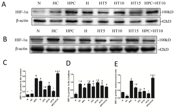 Effect of microtubule reticular changes on HIF-1 protein content.