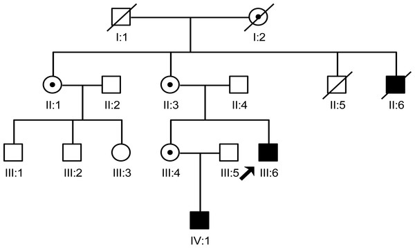The pedigree gram of this Chinese XLHED family.