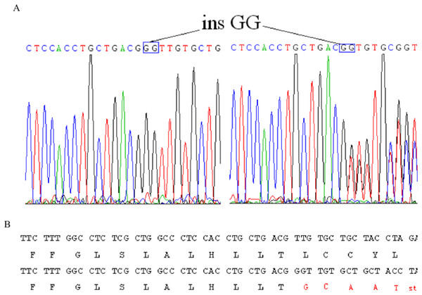 Identification of a novel 2-bp insertion mutation in the EDA gene.