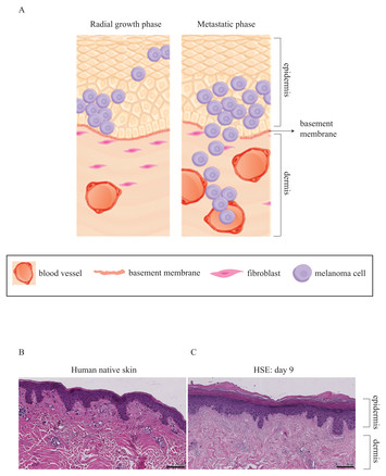 Quantitative comparison of the spreading and invasion of radial growth ...