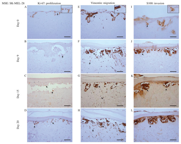 Proliferation, migration and invasion of skin cells and SK-MEL-28 melanoma cells.