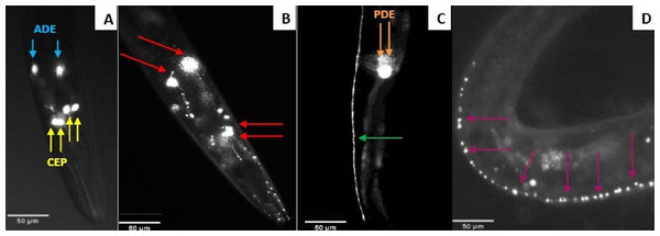 Fluorescent microscopy observation of C. elegans dopaminergic neurons.