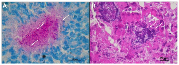 Histological observations on the mice that had died of sepsis after infection by N. cyriacigeorgica GUH-2.