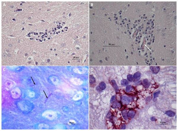 Histology of mice brains infected by N. farcinica 10152, with motor behavior disorders.