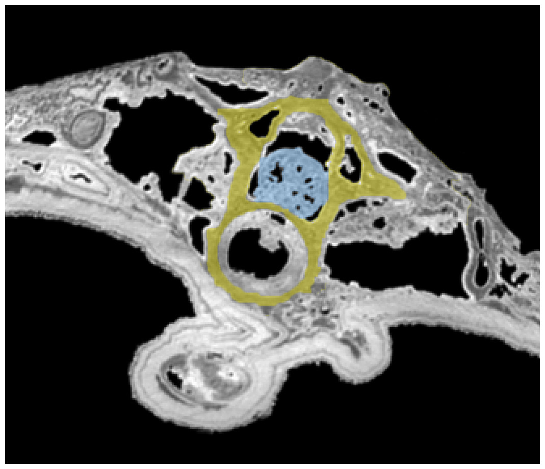 Tomograma do tronco de MNHN.F.QU17755: a medula espinhal (azul) continua preservada no interior de uma vértebra (amarela).