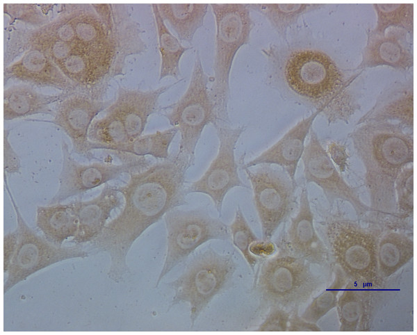 ECs infected with CSFV titrated by indirect immunofluorescence.