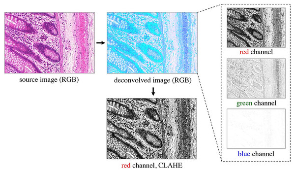 Preprocessing of the RGB images.