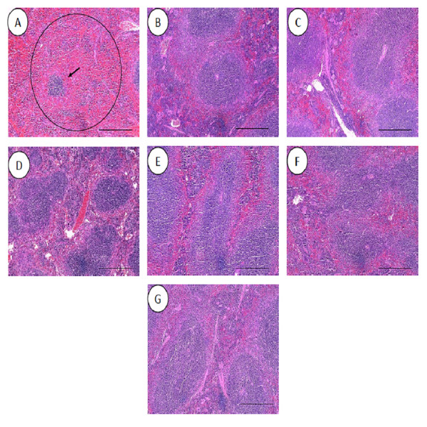 Histology of spleens harvested from mice infected with S. pneumoniae receiving treatments.
