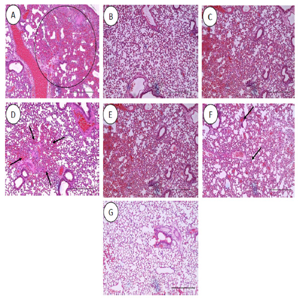 Histology of lungs harvested from mice infected with S. pneumoniae receiving treatments.