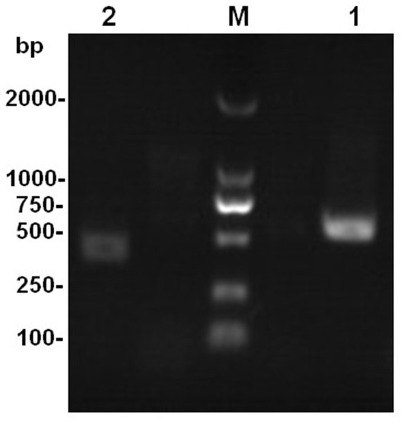 The amplification product of the rDNA-ITS gene from strains Ta-01 and Ta-02.