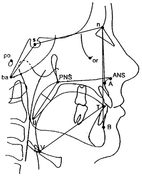Diagram showing the anatomical points, lines, and angles used to evaluate craniofacial morphology.