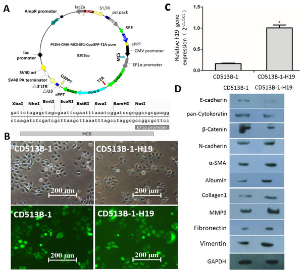 H19 promotes EMT progression and ECM protein expression induced by TGF-β1 in MAC-T cells.