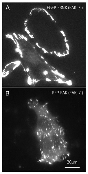 TIRFM image of FAK−∕− fibroblasts transfected with GFP-FRNK and RFP-FAK.