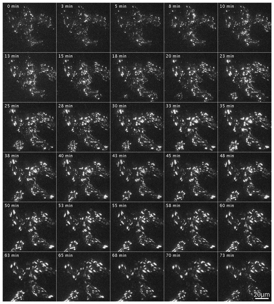 Organization of focal adhesions by FAK−∕− fibroblasts transfected with RFP-FAK after Rho-kinase inhibitor treatment.