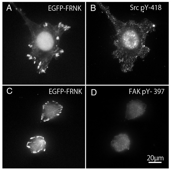 GFP-FRNK transfected cells (A and C) were stained with anti-tyrosine phosphorylated c-Src (B) and anti-tyrosine phosphorylated FAK (D).