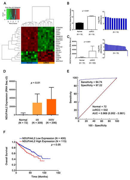 NDUFA4L2 is overexpressed and correlates with poor prognosis in ccRCC.