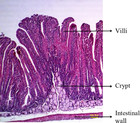 Impacts of diarrhea on the immune system, intestinal environment, and ...