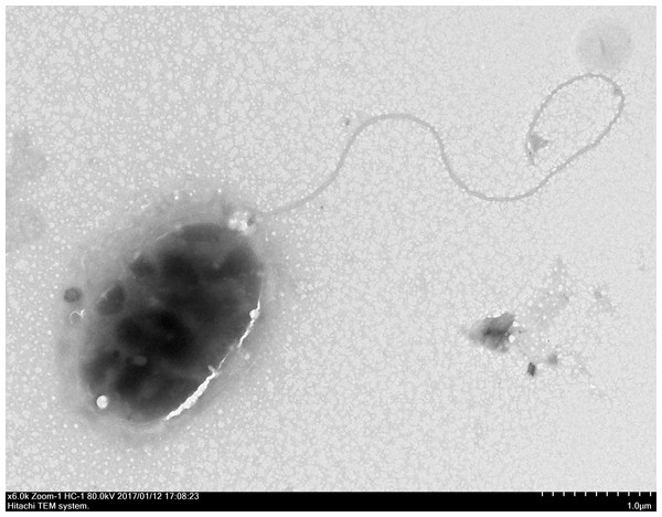 The electron micrograph of bacterium QT520 (X6000).