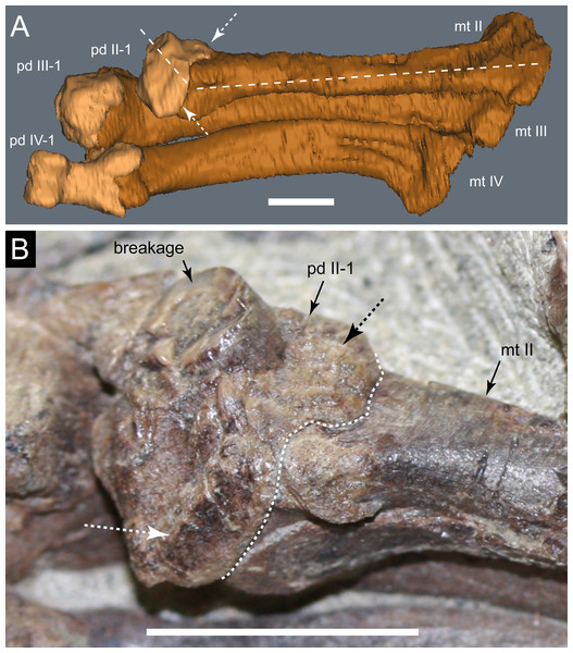 Diluvicursor pickeringi gen. et sp. nov. holotype (NMV P221080), potential pathologies of the right pes.