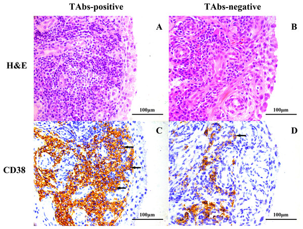  Representative images of H&E and immunohistochemical staining for CD38 in the synovium of RA patients based on TAb status.