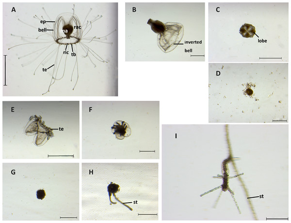 Stages of reverse development in Turritopsis sp.5 from Xiamen, China.