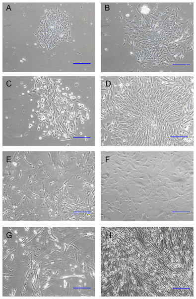 Optimization of culture media for DP cells.