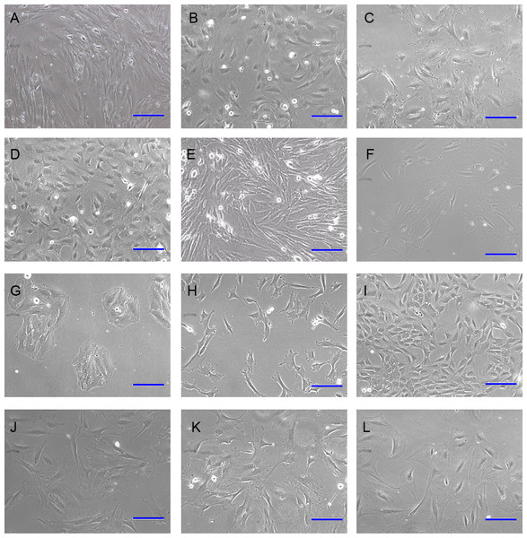 Morphology of immortalized cell strains.