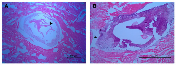 Histological sections of orange-colored protrusions in the muscle of Lobatus gigas.