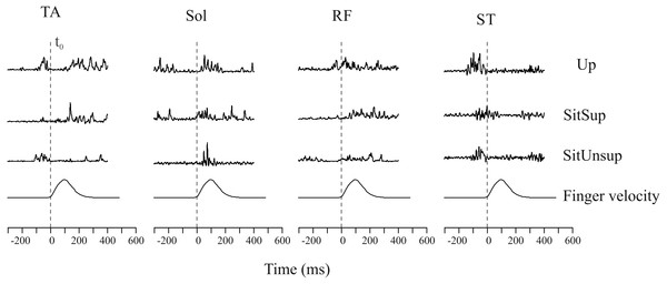 Raw muscle activity of a typical subject recorded during one single trial.