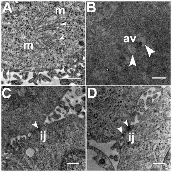 Exemplar TEM images of mitochondria, autophagic vacuoles and intercellular junctions.