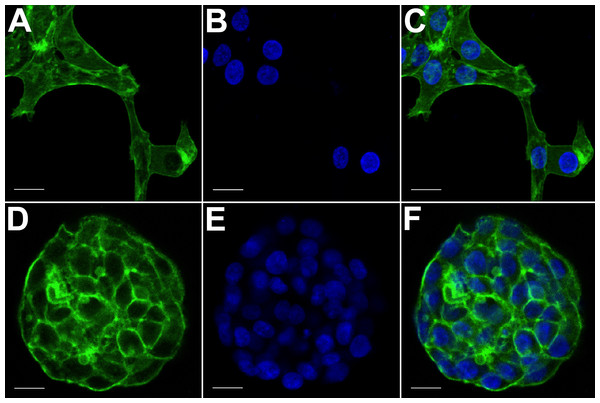 Confocal microscopy of HCC70 cells cultured in monolayer and hydrogel environments.