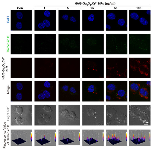 Immunocytochemical analysis shown the uptaken of HA/β-Ga2O3:Cr3+ NPs and the activation of Cathepsin B in SH-SY5Y cells.