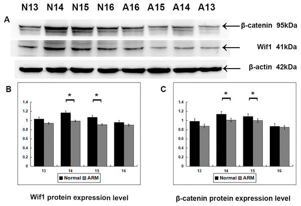 Western blot analysis of Wif1 and β-catenin protein.