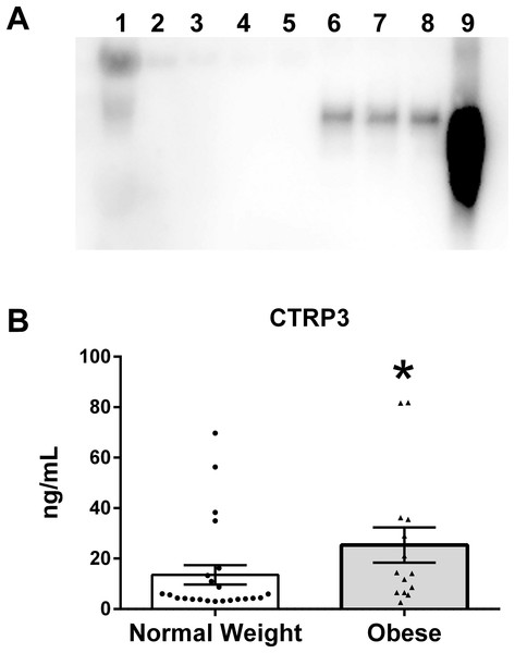 CTRP3 in human breast milk (BM).