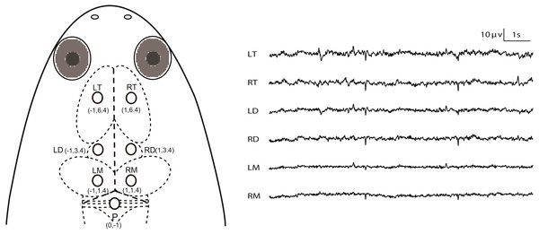 Electrode placements and 10 s of typical artifact-free EEG tracings for each channel during Stage I.