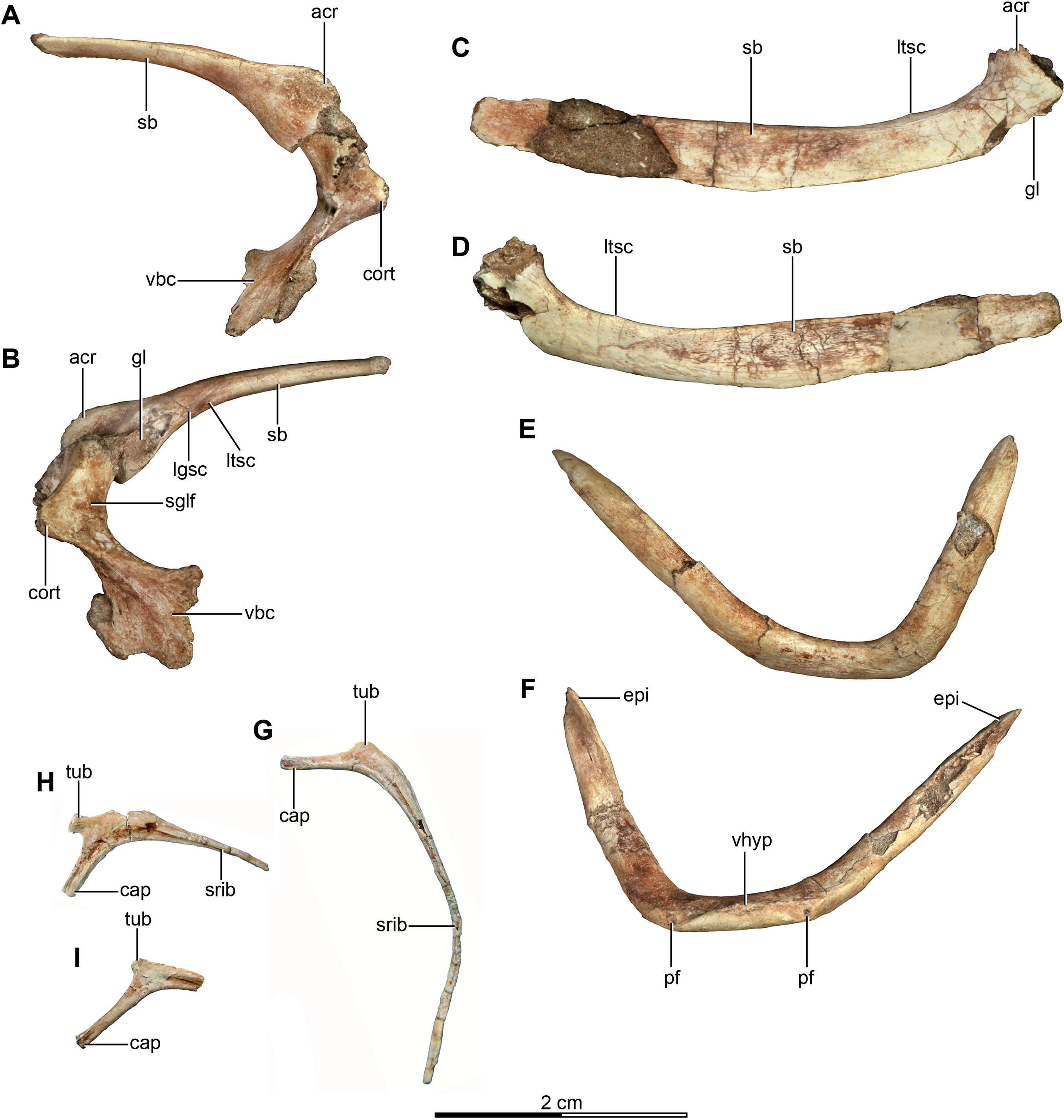Postcranial skeletal anatomy of the holotype and referred specimens of