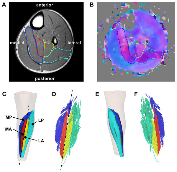 Reconstruction of the architecture of the human soleus muscle using MRI and DTI.