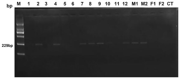 The electrophoresis results of test and control samples by PCR.