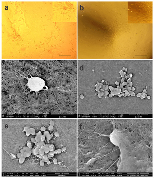 Photomicrographs of BM-MSCs adhered to the bacterial cellulose membrane (BCM) and scanning electron microscopy showing BM-MSC anchorage and biointegration with the BCM.