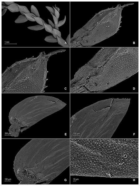 Scanning electron micrographs of branch section and leaves of S. zartmanii.
