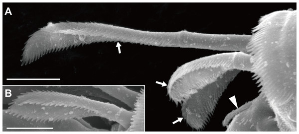 Haimormus shimojiensis gen. et sp. nov., paratype female (NSMT-Cr 26837), SEM images.