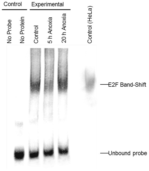 Electromobility shift assay (EMSA) for the E2F family of transcription factors.