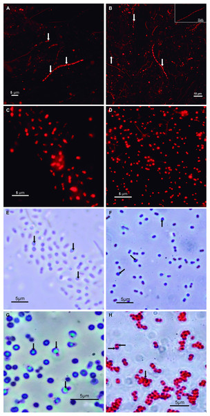 Micrographs of environmental samples and strains showing PHA granules.